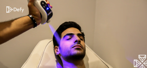 Cryotherapy and Skin Miracles