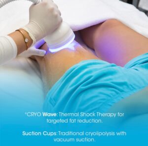 نحت البطن بتقنية كرايو للتخسيس.. حل آمن وفعال 
